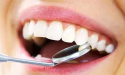 Diş Etiniz Sağlıklı mı? Bu Belirtilere Dikkat!