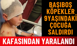 9 Yaşındaki Çocuk Başıboş Köpeğin Saldırısına Uğradı