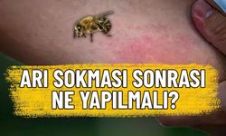 Arı Alerjisi Nedir ve Nasıl Anlaşılır?