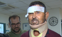 Aslan Dehşetinden Kurtuldu, Hakkını Helal Etti