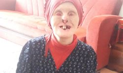 Rabia Yeralmaz hastalığı nedir? Rabia Yeralmaz kimdir?