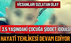 3,5 Yaşındaki Çocuğa Şiddet İddiası