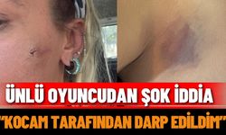 Ünlü oyuncudan şok iddia: “Kocam tarafından darp edildim”