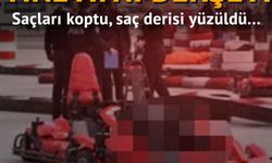 Go Kart'a Saçları Takıldı Saç Derisi Yüzüldü