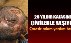 20 Yıldır Kafasında Çiviler Olan Hastanın Isparta'da Tedavisi Yarım Kaldı