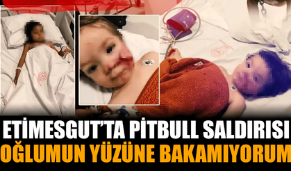 Ankara'da Pitbull Saldırısı: “Oğlumun Yüzüne Bakamıyorum”