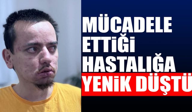 Uzun süredir mücadele ettiği hastalığa yenik düştü