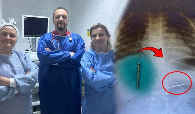 2 Yaşındaki Çocuğun Midesinden Yuttuğu Çivi Endoskopik Yöntemle Çıkarıldı
