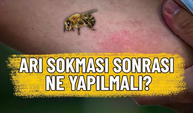 Arı Alerjisi Nedir ve Nasıl Anlaşılır?
