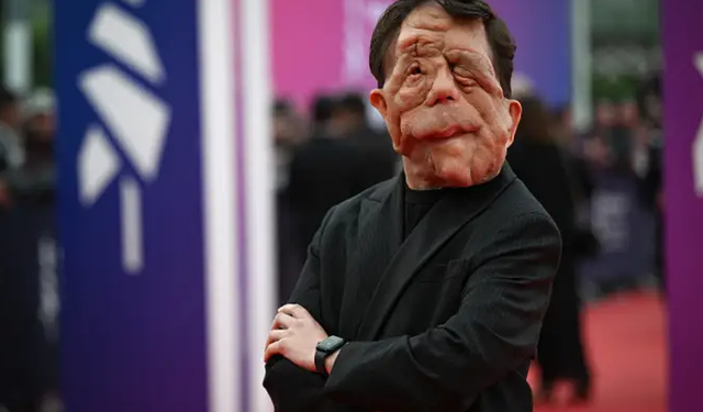 Adam Pearson Kimdir? Yüzüne Ne Oldu ve Hastalığı Nedir? Filmleri ve Hayatı