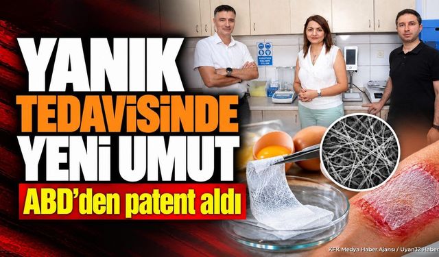 SDÜ'nün Yumurta Akı Esaslı Yara Örtüsüne ABD'den Patent Geldi