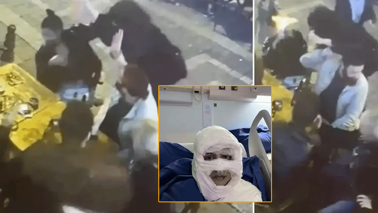 Kadikoy Kolonya Saldiri1