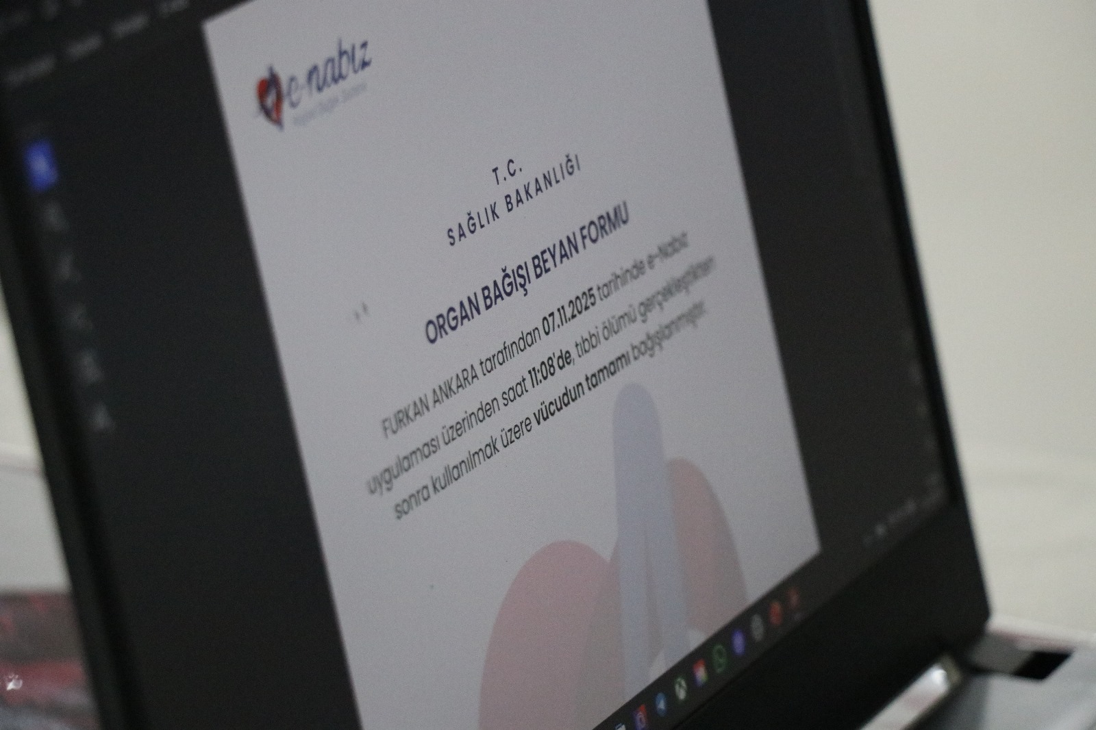 Organ Bekleyen Binlerce Hastaya Umut Sdü'den Yükseliyor! (8)