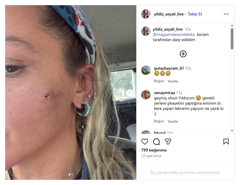 Ünlü oyuncudan şok iddia: “Kocam tarafından darp edildim”-1